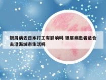 银屑病去日本打工有影响吗 银屑病患者适合去沿海城市生活吗