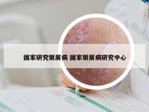 国家研究银屑病 国家银屑病研究中心