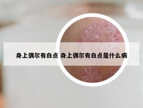 身上偶尔有白点 身上偶尔有白点是什么病