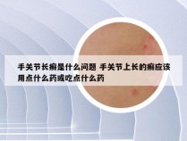 手关节长癣是什么问题 手关节上长的癣应该用点什么药或吃点什么药