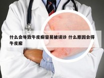 什么会导致牛皮癣容易被误诊 什么原因会得牛皮廨