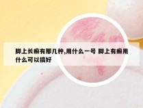 脚上长癣有那几种,用什么一号 脚上有癣用什么可以搞好