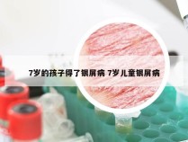 7岁的孩子得了银屑病 7岁儿童银屑病