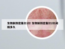 生物制剂密集针2针 生物制剂密集针2针间隔多久