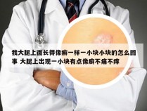 我大腿上面长得像癣一样一小块小块的怎么回事 大腿上出现一小块有点像癣不痛不痒