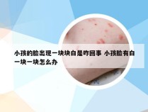 小孩的脸出现一块块白是咋回事 小孩脸有白一块一块怎么办