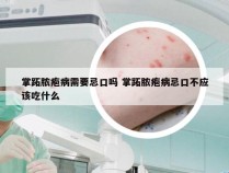 掌跖脓疱病需要忌口吗 掌跖脓疱病忌口不应该吃什么