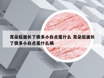 耳朵后面长了很多小白点是什么 耳朵后面长了很多小白点是什么病