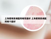 上海看银屑病医院哪家最好 上海看银屑病医院哪个最好