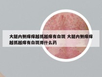 大腿内侧痒痒越抓越痒有白斑 大腿内侧痒痒越抓越痒有白斑用什么药