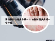 生物制剂价格多少钱一针 生物制剂多少钱一个疗程?