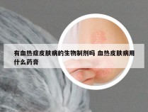 有血热症皮肤病的生物制剂吗 血热皮肤病用什么药膏