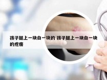 孩子腿上一块白一块的 孩子腿上一块白一块的疙瘩