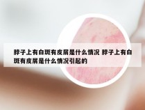 脖子上有白斑有皮屑是什么情况 脖子上有白斑有皮屑是什么情况引起的