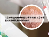 北京哪家医院皮肤科能打生物制剂 北京哪家医院皮肤科能打生物制剂的