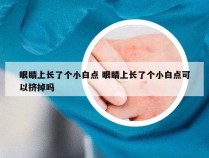 眼睛上长了个小白点 眼睛上长了个小白点可以挤掉吗