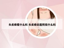 头皮癣看什么科 头皮癣去医院挂什么科