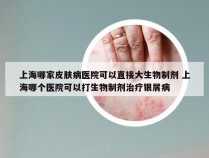 上海哪家皮肤病医院可以直接大生物制剂 上海哪个医院可以打生物制剂治疗银屑病