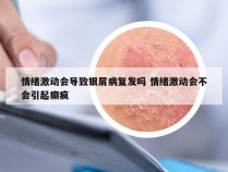 情绪激动会导致银屑病复发吗 情绪激动会不会引起癫疯