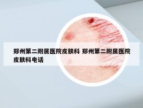 郑州第二附属医院皮肤科 郑州第二附属医院皮肤科电话