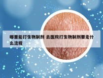 哪里能打生物制剂 去医院打生物制剂要走什么流程