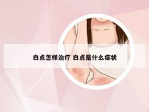 白点怎样治疗 白点是什么症状