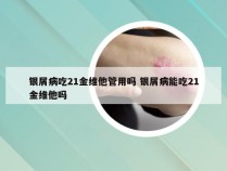 银屑病吃21金维他管用吗 银屑病能吃21金维他吗