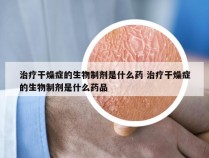 治疗干燥症的生物制剂是什么药 治疗干燥症的生物制剂是什么药品