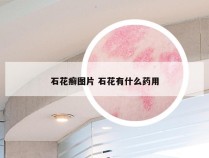 石花癣图片 石花有什么药用