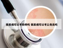 银屑病可以考教师吗 银屑病可以考公务员吗