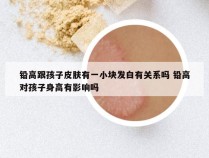 铅高跟孩子皮肤有一小块发白有关系吗 铅高对孩子身高有影响吗