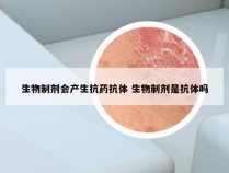 生物制剂会产生抗药抗体 生物制剂是抗体吗