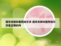 盛京皮肤科医院哈尔滨 盛京皮肤科医院哈尔滨是正规的吗