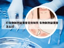 打生物制剂益赛普见效如何 生物制剂益赛普怎么打