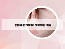 怎样预防白斑病 白斑如何预防