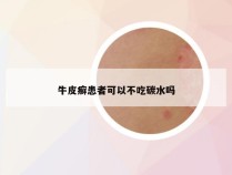 牛皮癣患者可以不吃碳水吗