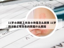 11岁小孩脸上长白小块是怎么回事 11岁孩子脸上有白色的斑是什么原因