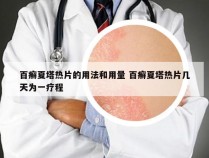 百癣夏塔热片的用法和用量 百癣夏塔热片几天为一疗程