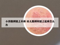 小孩胳膊腿上长癣 幼儿胳膊和腿上起癣怎么办