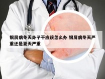 银屑病冬天身子干应该怎么办 银屑病冬天严重还是夏天严重