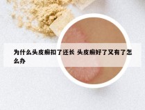 为什么头皮癣扣了还长 头皮癣好了又有了怎么办