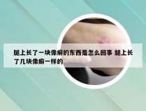 腿上长了一块像癣的东西是怎么回事 腿上长了几块像癣一样的