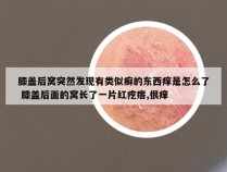 膝盖后窝突然发现有类似癣的东西痒是怎么了 膝盖后面的窝长了一片红疙瘩,很痒