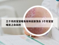 三个月的宝宝嘴角有块皮肤发白 3个月宝宝嘴皮上白白的