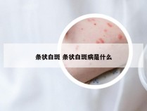 条状白斑 条状白斑病是什么