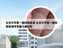 北京大学第一医院银屑病 北京大学第一医院银屑病专家哪个看的好