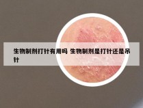 生物制剂打针有用吗 生物制剂是打针还是吊针