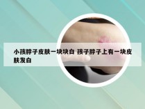 小孩脖子皮肤一块块白 孩子脖子上有一块皮肤发白