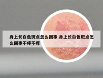 身上长白色斑点怎么回事 身上长白色斑点怎么回事不疼不痒