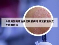 外用康复新液治头皮银屑病吗 康复新液头皮外用的用法